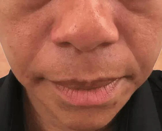 Undefined Cheekbones