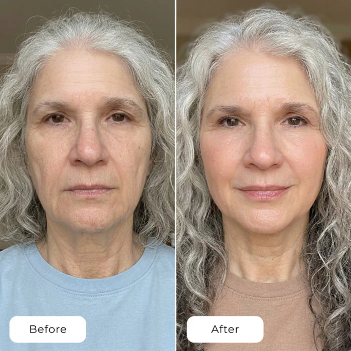 Before and after using Naraskin Lab