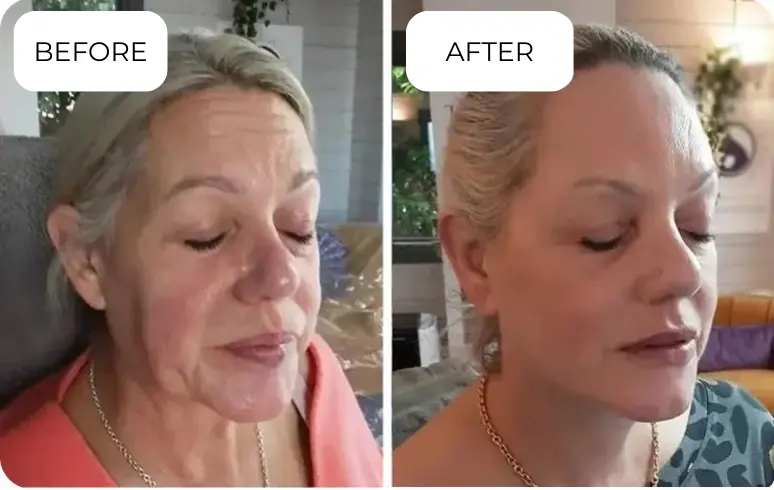 Katie, 59, FL before and after